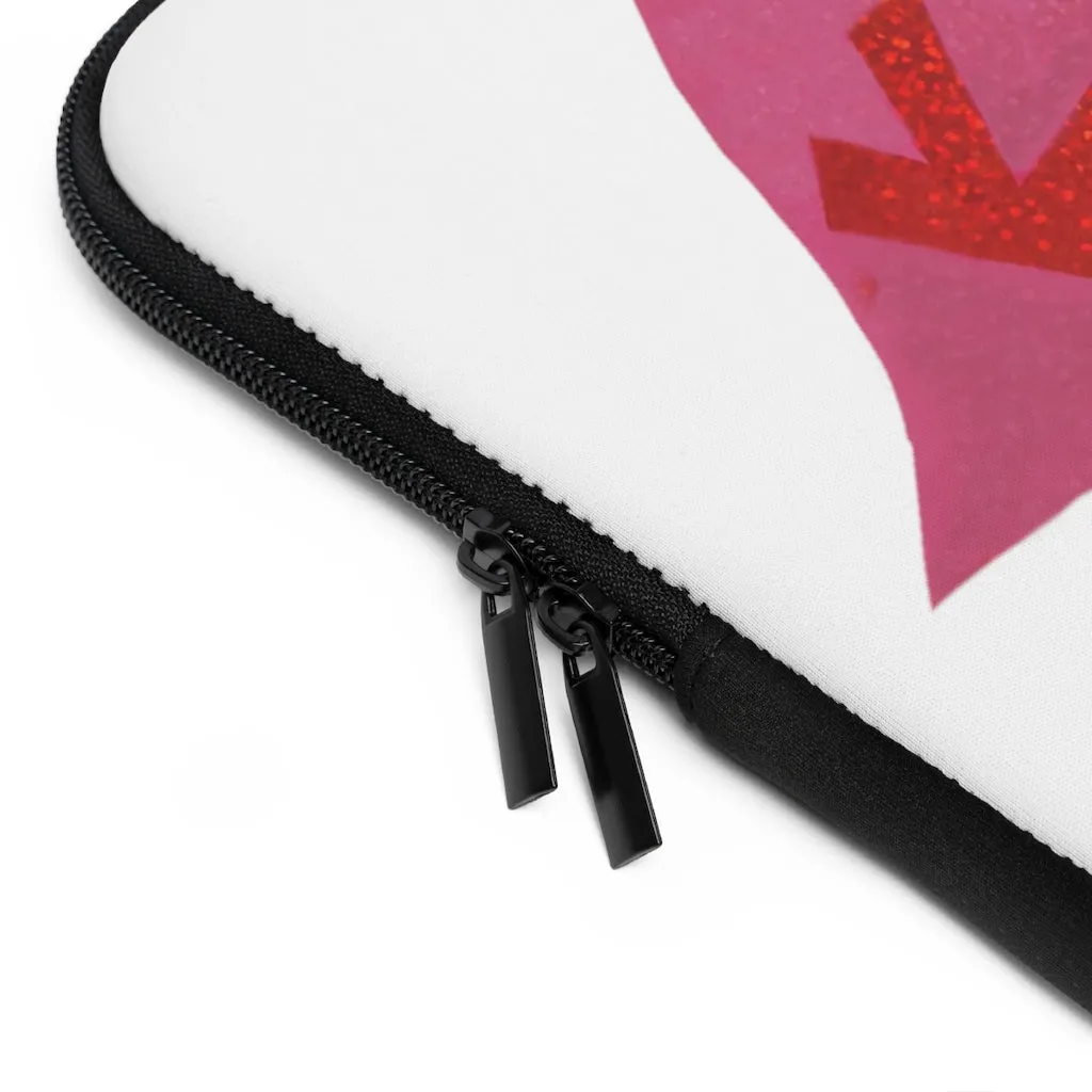 Kiss Me Laptop Sleeve